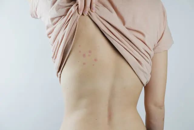 The Blood Diet Why Do Bed Bugs Feed on Humans